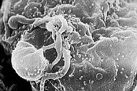 Virus HIV-1, posnet z rasterskim mikroskopom